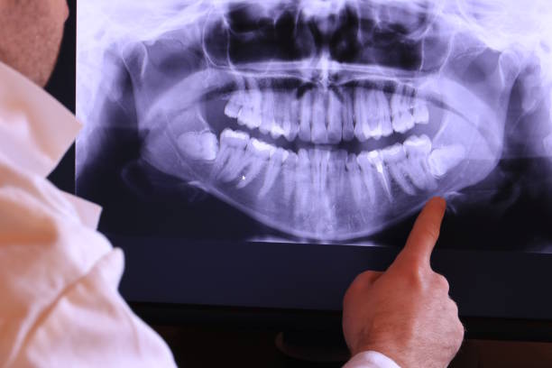 Best Chipped Tooth Repair Near Me  in Ambridge, PA
