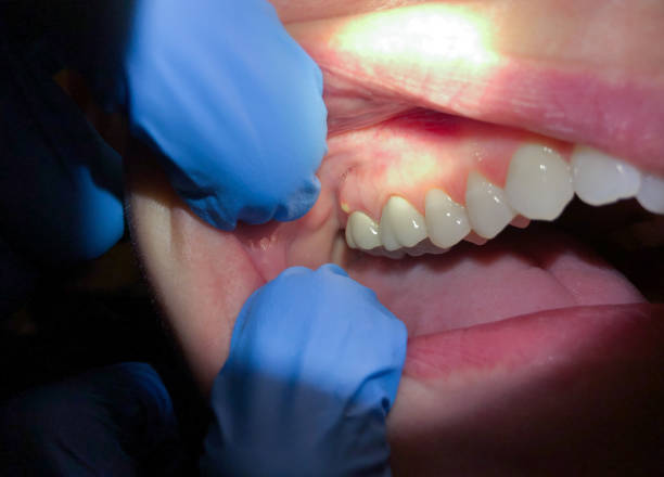 Best Emergency Gum Pain Relief  in Ambridge, PA