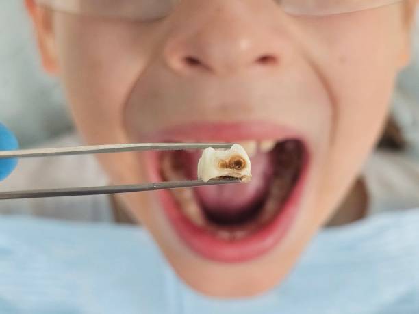 Best Emergency Tooth Extraction  in Ambridge, PA